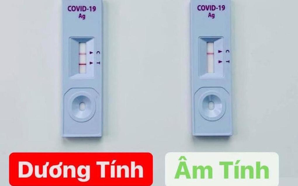 Khi tự test nhanh cho kết quả dương tính, người dân cần xử trí như thế nào?