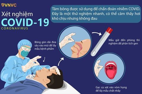 Địa điểm theo dõi y tế phòng chống dịch covid-19 (cập nhập 19h00 ngày 18/7/2021)